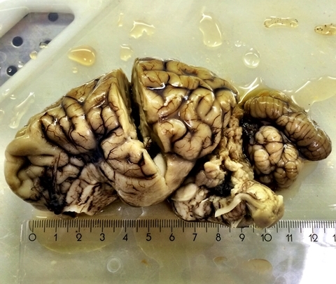 Cerebro de un reno enfermo de caquexia crónica