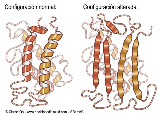 Proteína normal y prion (imagen de www.enciclopediasalud.com de V.Barceló)