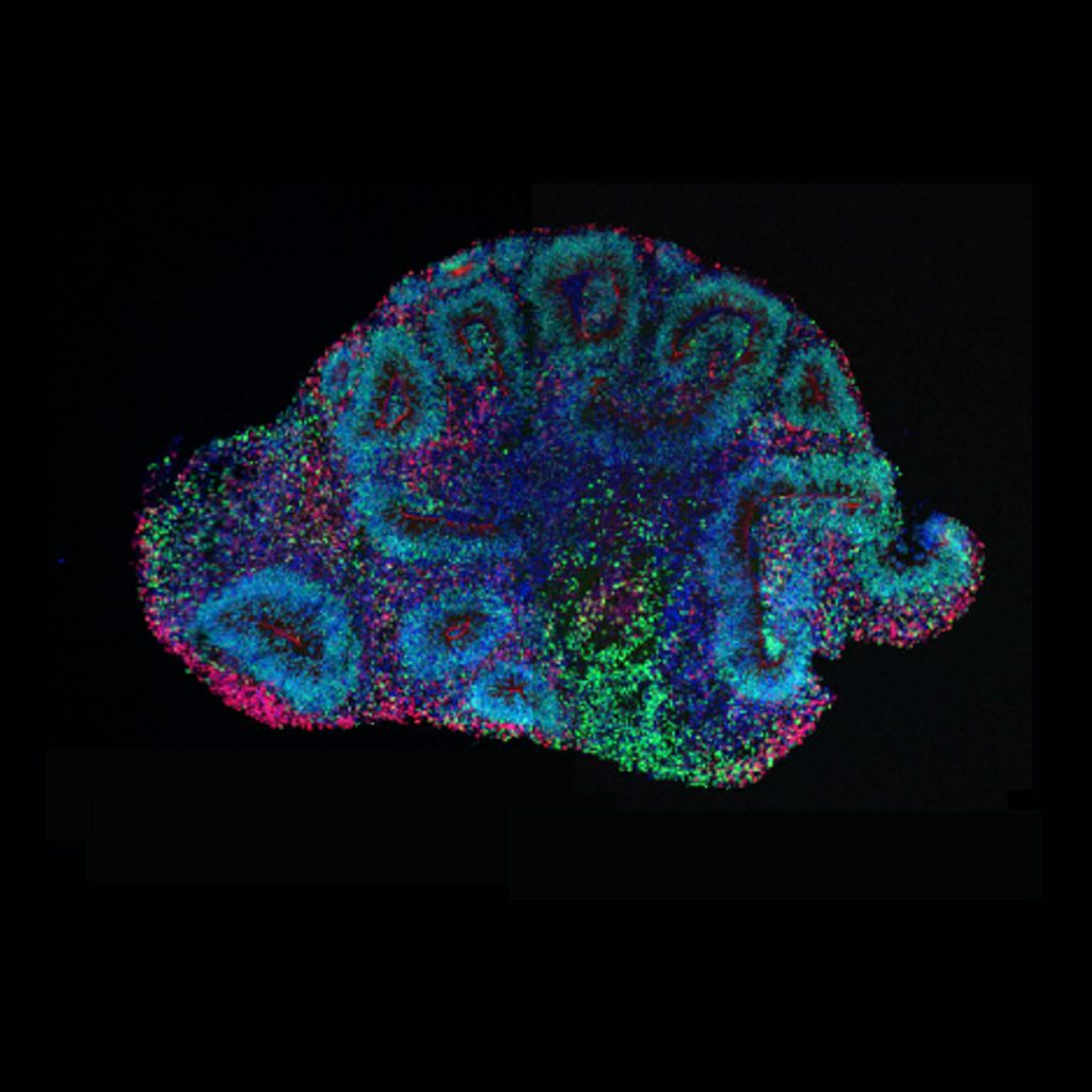 Organoide de un cerebro marcado como portada del episodio de Coffee Break: Neuronas de cultivo, VIH vs CRISPR, metano en Marte